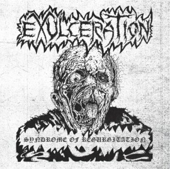 EXULCERATION - Syndrome of regurgitation DLP+CD